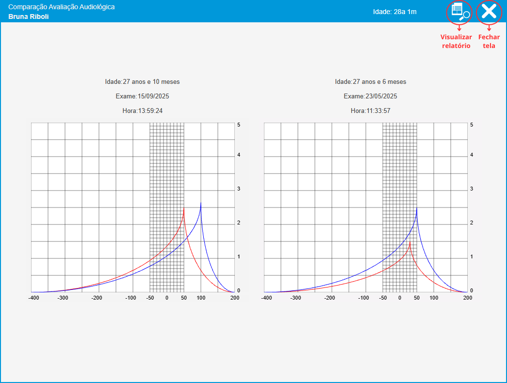 Comparação de Imitanciometrias