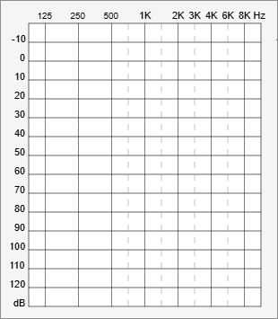 Gráfico Audiométrico Modelo 2