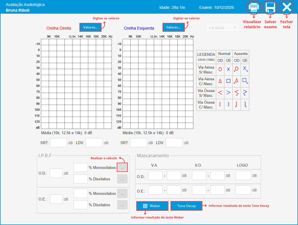 Audiometria de Altas Frequências