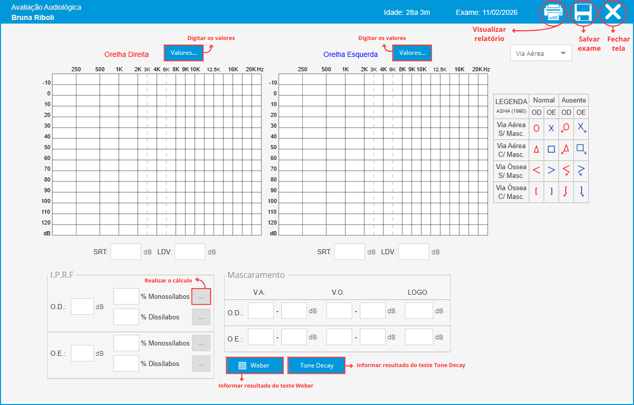 Audiometria Estendida