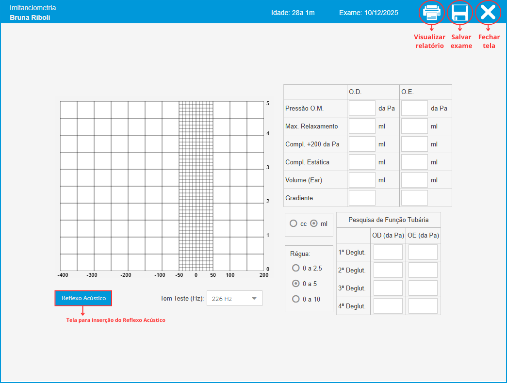 Imitanciometria Modelo 1