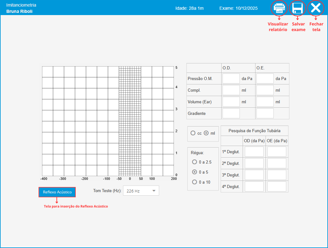 Imitanciometria Modelo 2