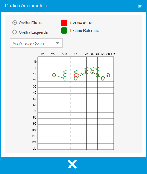 Gráfico Audiométrico - Parecer Audiológico Ocupacional